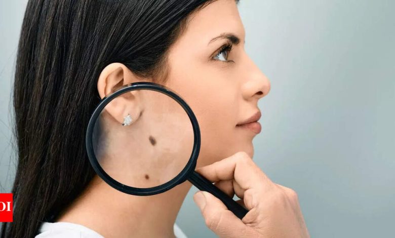 Understanding the hidden meanings of lucky moles on the female body. Understanding the hidden meanings of lucky moles on the female body.